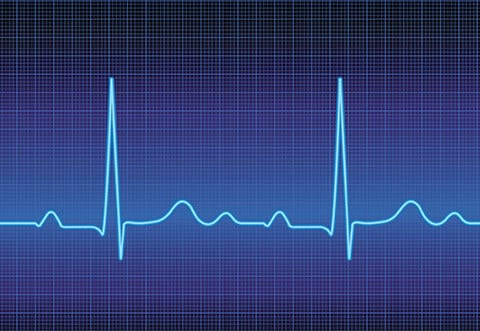 Grid-SmartTake-HeartValveDisease - Smart-Fill EKG Monitor Line