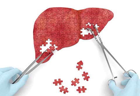 Grid-SmartTake-Hepatitis - Smart-Fill Doctor using tools to disassemble a heart puzzle